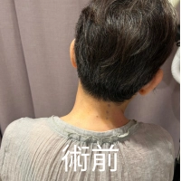 【黃于軒醫師聊聊天】不是只有手麻——當脖子連「往右轉、往右彎」都卡住,心悸也跟著來了 【黃于軒醫師聊聊天】不是只有手麻——當脖子連「往右轉、往右彎」都卡住,心悸也跟著來了