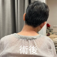 【黃于軒醫師聊聊天】不是只有手麻——當脖子連「往右轉、往右彎」都卡住,心悸也跟著來了 【黃于軒醫師聊聊天】不是只有手麻——當脖子連「往右轉、往右彎」都卡住,心悸也跟著來了