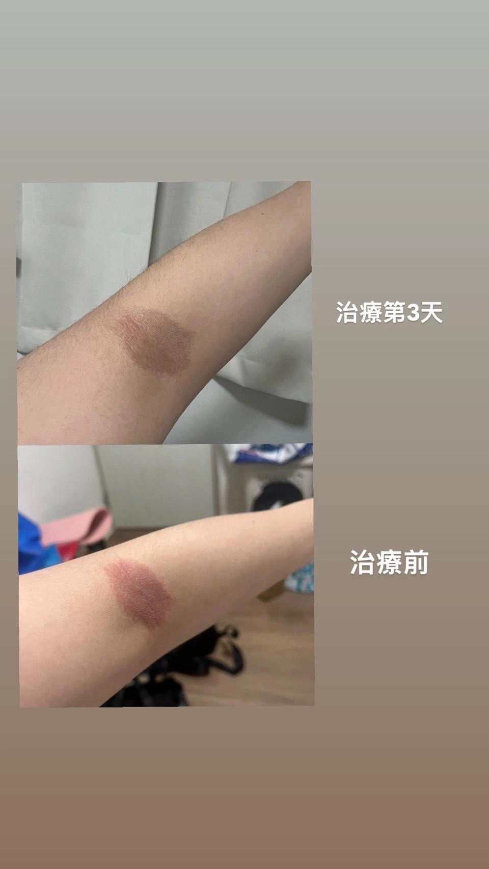 【黃于軒醫師聊聊天】她才20幾歲,卻每天凌晨五、六點才能睡。後來連濕疹都找上門了 【黃于軒醫師聊聊天】她才20幾歲,卻每天凌晨五、六點才能睡。後來連濕疹都找上門了