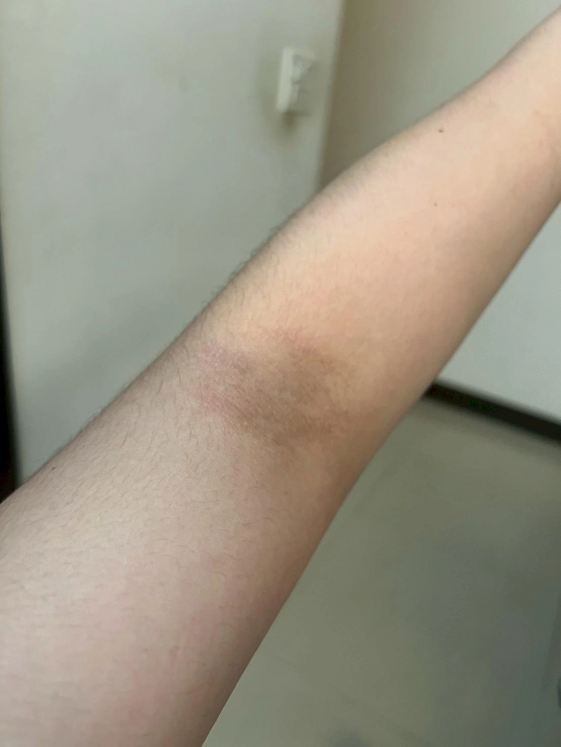 【黃于軒醫師聊聊天】她才20幾歲,卻每天凌晨五、六點才能睡。後來連濕疹都找上門了 【黃于軒醫師聊聊天】她才20幾歲,卻每天凌晨五、六點才能睡。後來連濕疹都找上門了