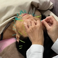 【劉盈盈醫師聊聊天】睡得夠卻總覺得沒精神？臉上的疲態，可能來自你沒發現的皺眉習慣