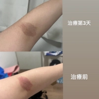 【黃于軒醫師聊聊天】她才20幾歲，卻每天凌晨五、六點才能睡。後來連濕疹都找上門了