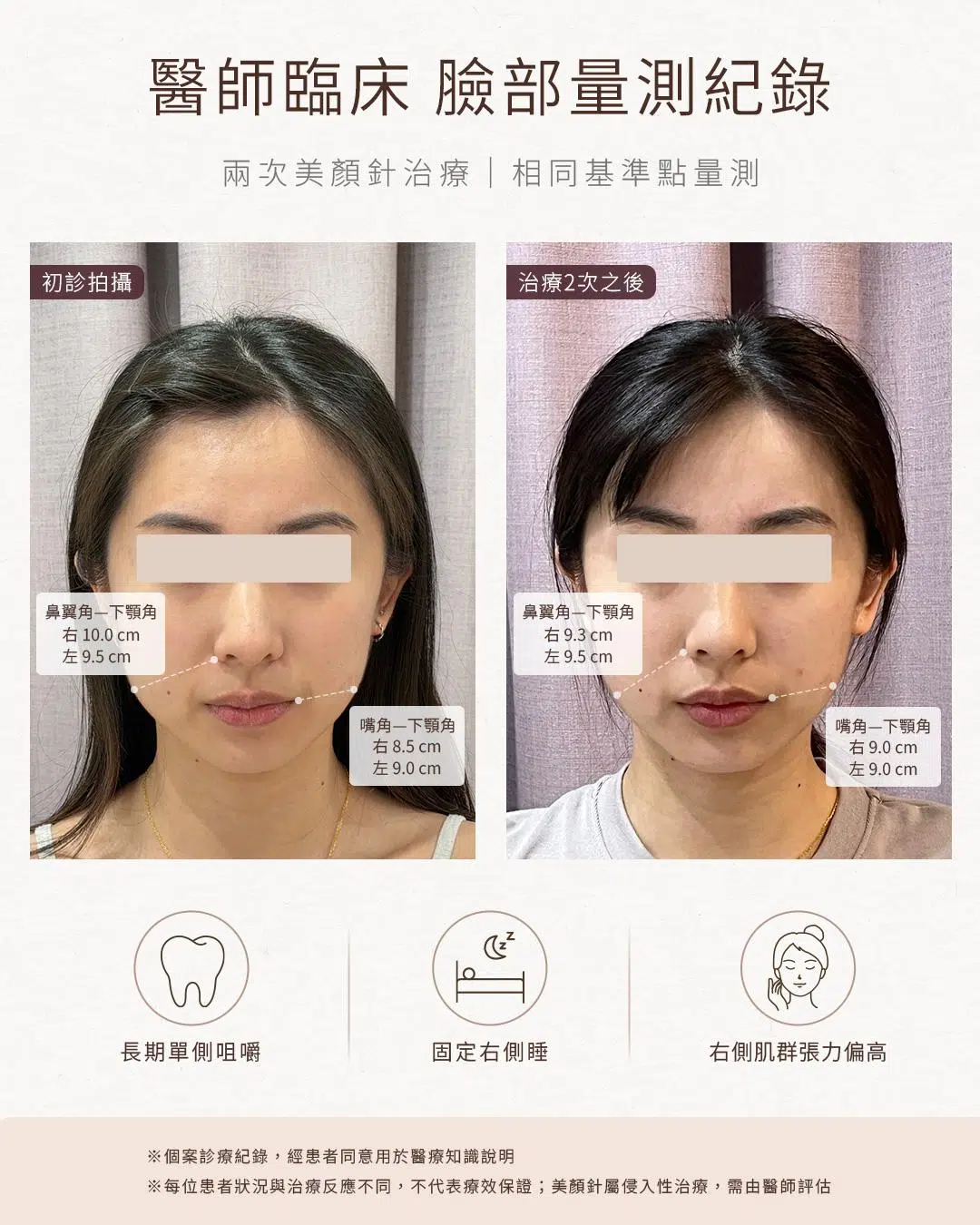 【劉盈盈醫師聊聊天】拍照永遠只敢側45度?大小臉的原因,藏在你每天的習慣裡 【劉盈盈醫師聊聊天】拍照永遠只敢側45度?大小臉的原因,藏在你每天的習慣裡