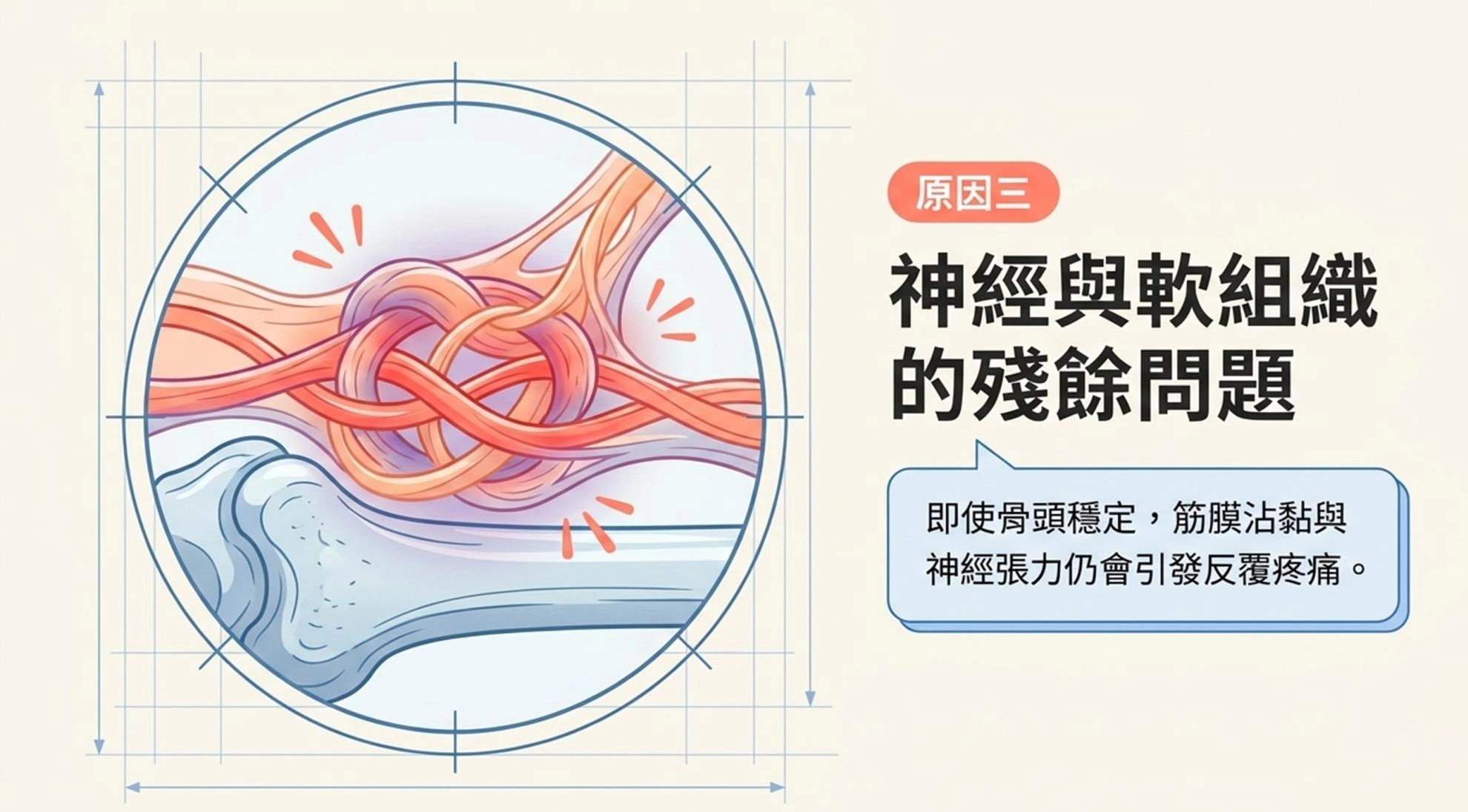 【黃醫師聊聊天】開完刀還是痛？其實你的腰，只是「卡」住了